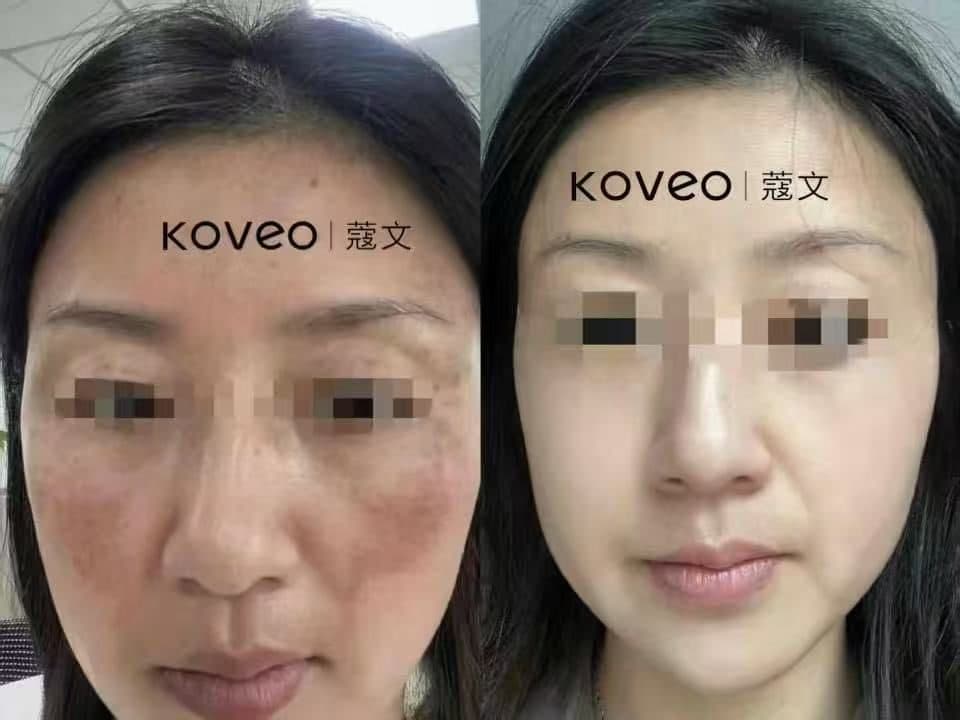 Фотография до и после ухода 4